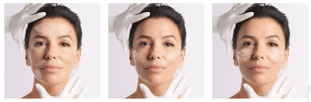 AI in Beauty Industry - L'Oréal Paris - Skin Genius